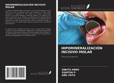 Couverture de HIPOMINERALIZACIÓN INCISIVO MOLAR