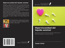 Buchcover von Hiperviscosidad del líquido seminal