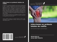 Buchcover von Infecciones en prótesis totales de rodilla