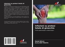 Infezioni su protesi totale di ginocchio的封面
