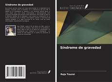 Buchcover von Síndrome de gravedad