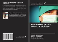 Buchcover von Puntos clave sobre el cáncer de estómago