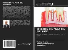 Buchcover von CONEXIÓN DEL PILAR DEL IMPLANTE