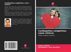 Buchcover von Cardiopatias congénitas: casos clínicos