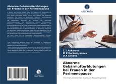 Abnorme Gebärmutterblutungen bei Frauen in der Perimenopause kitap kapağı