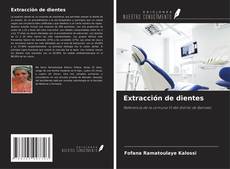 Portada del libro de Extracción de dientes