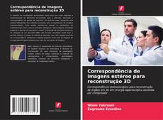 Portada del libro de Correspondência de imagens estéreo para reconstrução 3D