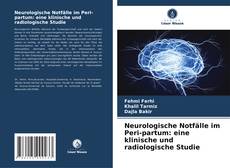 Neurologische Notfälle im Peri-partum: eine klinische und radiologische Studie kitap kapağı