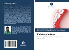 Zahnimplantate kitap kapağı