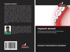 Couverture de Impianti dentali