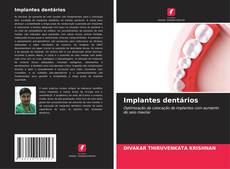 Capa do livro de Implantes dentários 