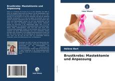 Copertina di Brustkrebs: Mastektomie und Anpassung