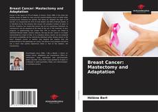 Breast Cancer: Mastectomy and Adaptation的封面
