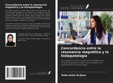 Bookcover of Concordancia entre la resonancia magnética y la histopatología