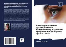Bookcover of Иллюстрированное руководство по клиническому изучению трифалы при синдроме сухого глаза