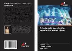Couverture de Ortodonzia accelerata: meccanica molecolare