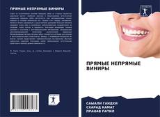 Portada del libro de ПРЯМЫЕ НЕПРЯМЫЕ ВИНИРЫ