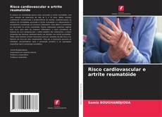 Couverture de Risco cardiovascular e artrite reumatóide