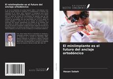 Buchcover von El miniimplante es el futuro del anclaje ortodóncico