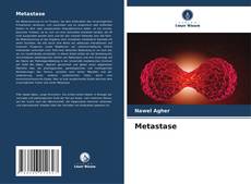 Bookcover of Metastase