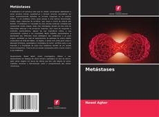 Couverture de Metástases