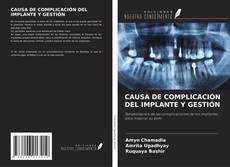 Buchcover von CAUSA DE COMPLICACIÓN DEL IMPLANTE Y GESTIÓN