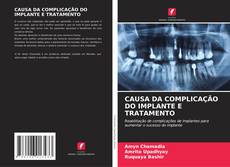 Bookcover of CAUSA DA COMPLICAÇÃO DO IMPLANTE E TRATAMENTO