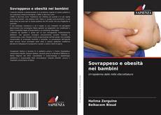 Bookcover of Sovrappeso e obesità nei bambini