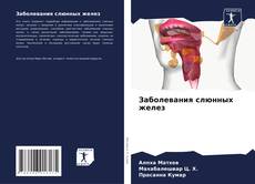 Capa do livro de Заболевания слюнных желез 