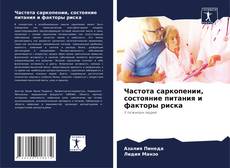 Bookcover of Частота саркопении, состояние питания и факторы риска