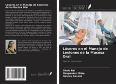 Обложка Láseres en el Manejo de Lesiones de la Mucosa Oral