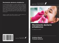 Buchcover von Movimiento dentario ortodóncico