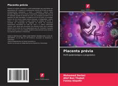 Placenta prévia kitap kapağı