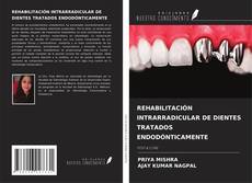 REHABILITACIÓN INTRARRADICULAR DE DIENTES TRATADOS ENDODÓNTICAMENTE kitap kapağı