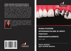 Couverture de RIABILITAZIONE INTRARADICOLARE DI DENTI TRATTATI ENDODONTICAMENTE