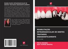 REABILITAÇÃO INTRARRADICULAR DE DENTES TRATADOS ENDODONTICAMENTE kitap kapağı