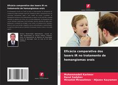 Bookcover of Eficácia comparativa dos lasers IR no tratamento de hemangiomas orais