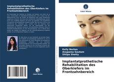 Portada del libro de Implantatprothetische Rehabilitation des Oberkiefers im Frontzahnbereich