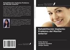 Rehabilitación Implanto-Protésica del Maxilar Anterior的封面