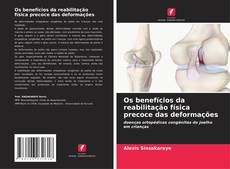 Bookcover of Os benefícios da reabilitação física precoce das deformações
