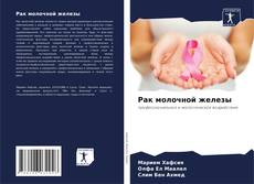 Capa do livro de Рак молочной железы 