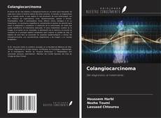 Buchcover von Colangiocarcinoma