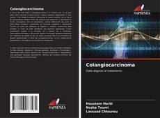 Bookcover of Colangiocarcinoma