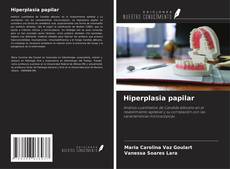 Portada del libro de Hiperplasia papilar