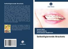 Copertina di Selbstligierende Brackets