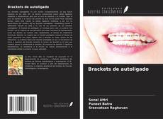 Capa do livro de Brackets de autoligado 