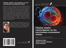 Buchcover von Células madre cancerígenas en los carcinomas escamosos orales