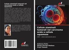 Buchcover von Cellule staminali tumorali nel carcinoma orale a cellule squamose