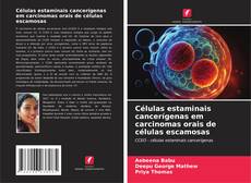 Capa do livro de Células estaminais cancerígenas em carcinomas orais de células escamosas 