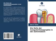 Copertina di Die Rolle der Computertomographie in der Zahnmedizin